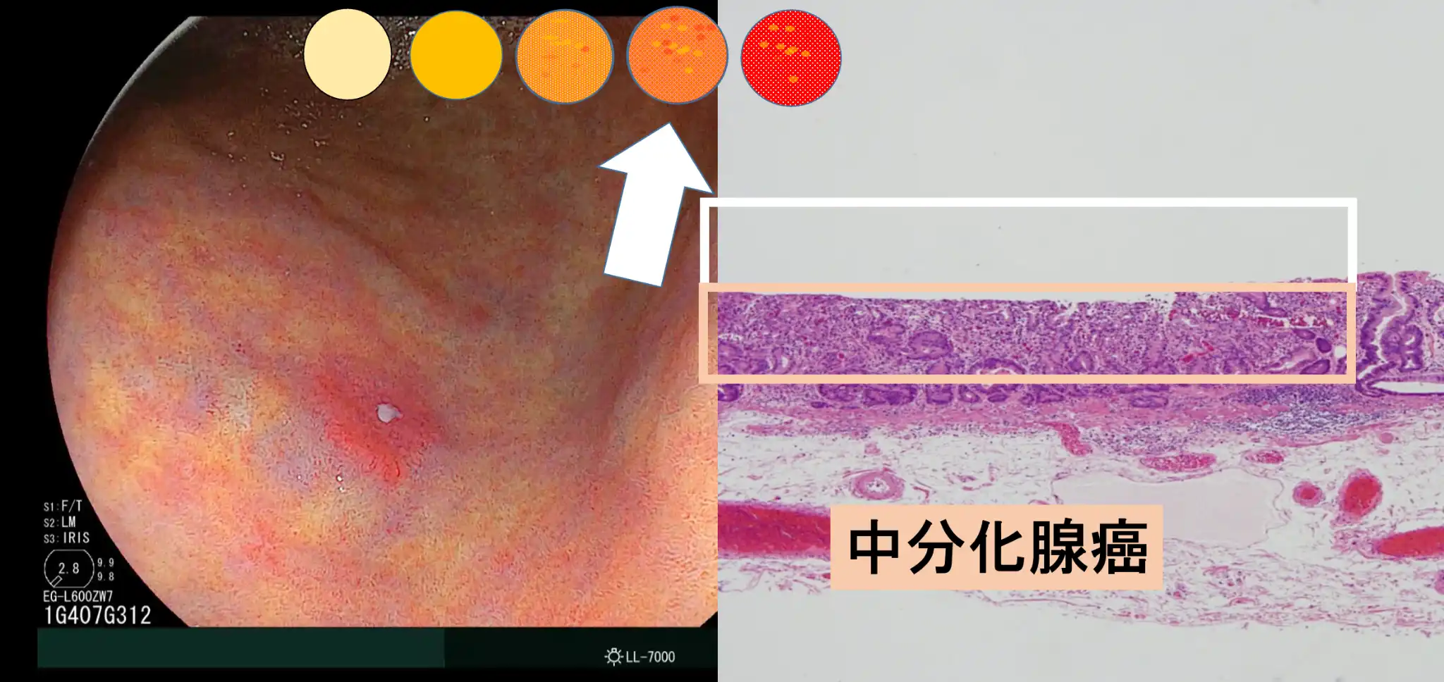 オレンジ領域の診断能力を高める