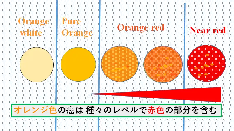 オレンジ領域の診断能力を高める