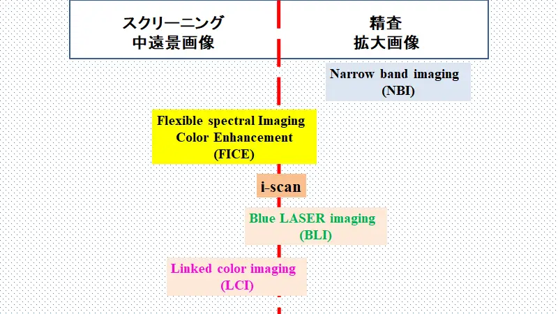 NBIから始まった画像強調内視鏡診断の歴史