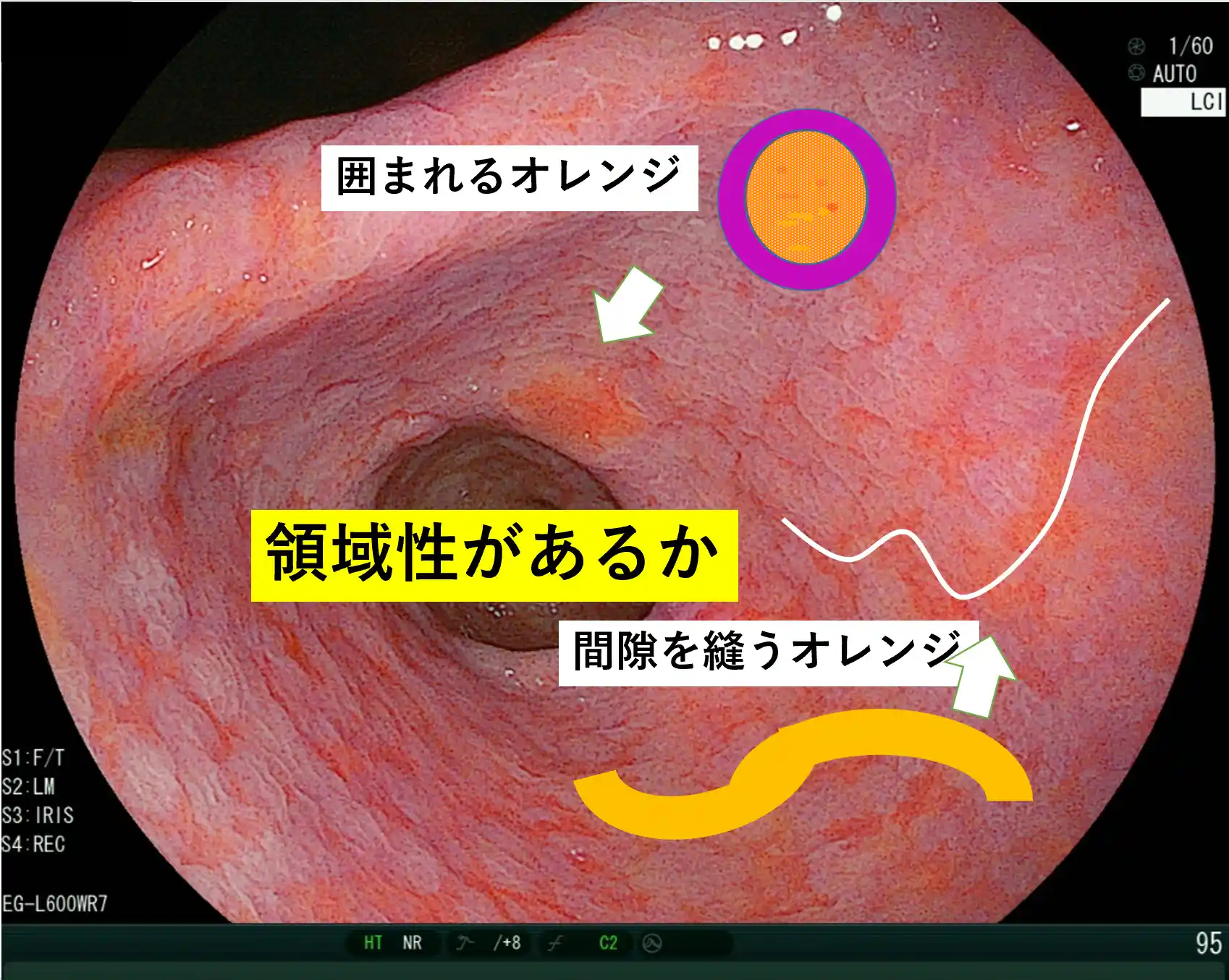 オレンジ色を発見した時に意識すること