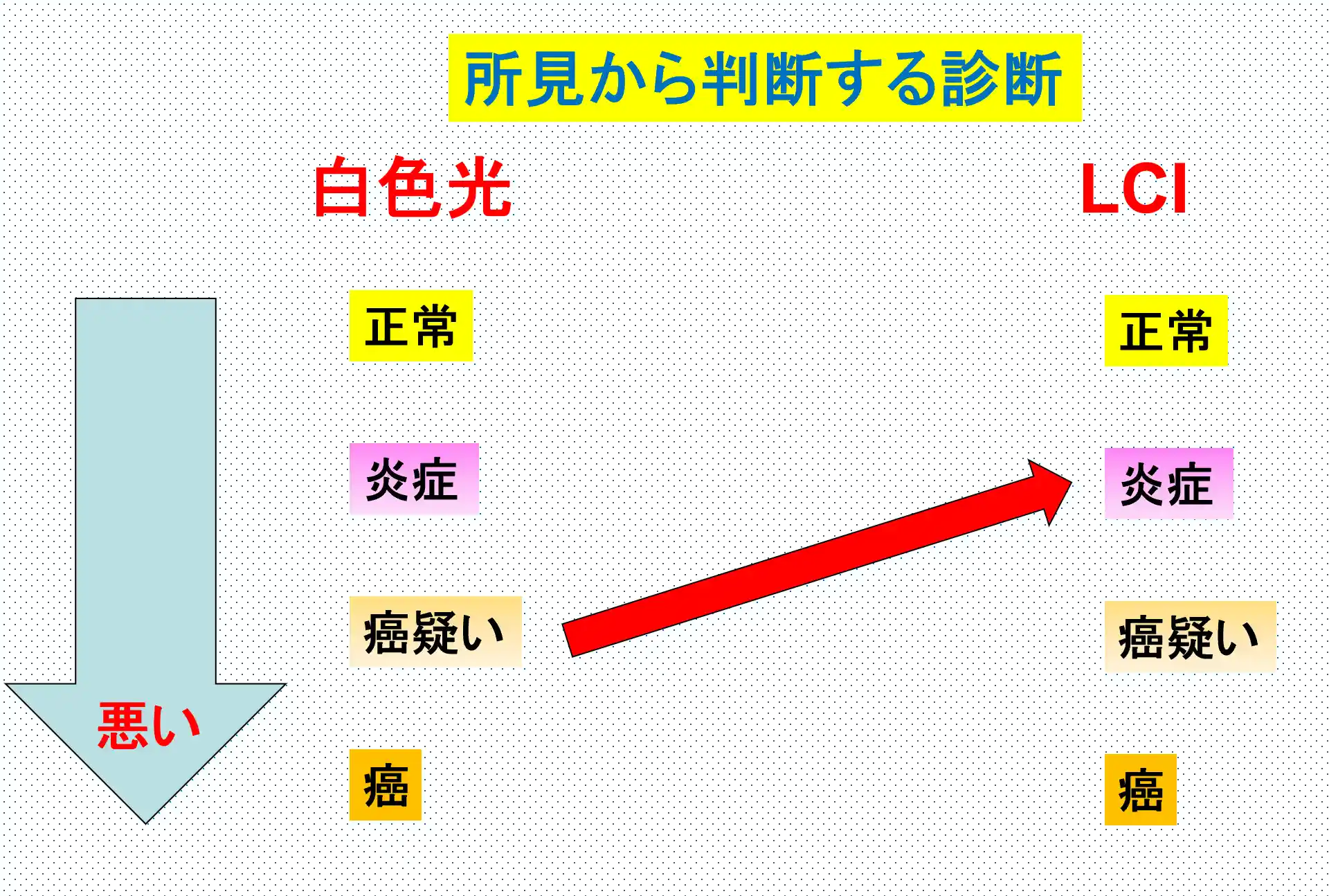 鑑別におけるLCIの有効性