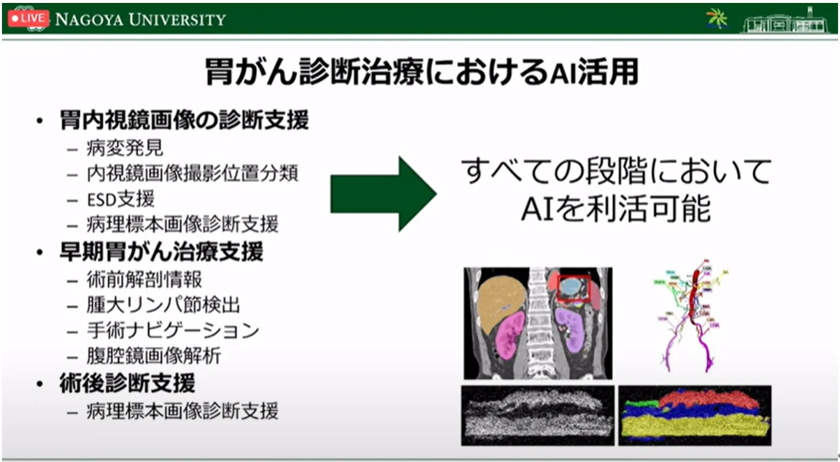 胃がん診断・治療のすべての段階でAI利活用の可能性を探る！名古屋大学大学院・森健策教授による最新研究の紹介（第94回日本胃癌学会総会）