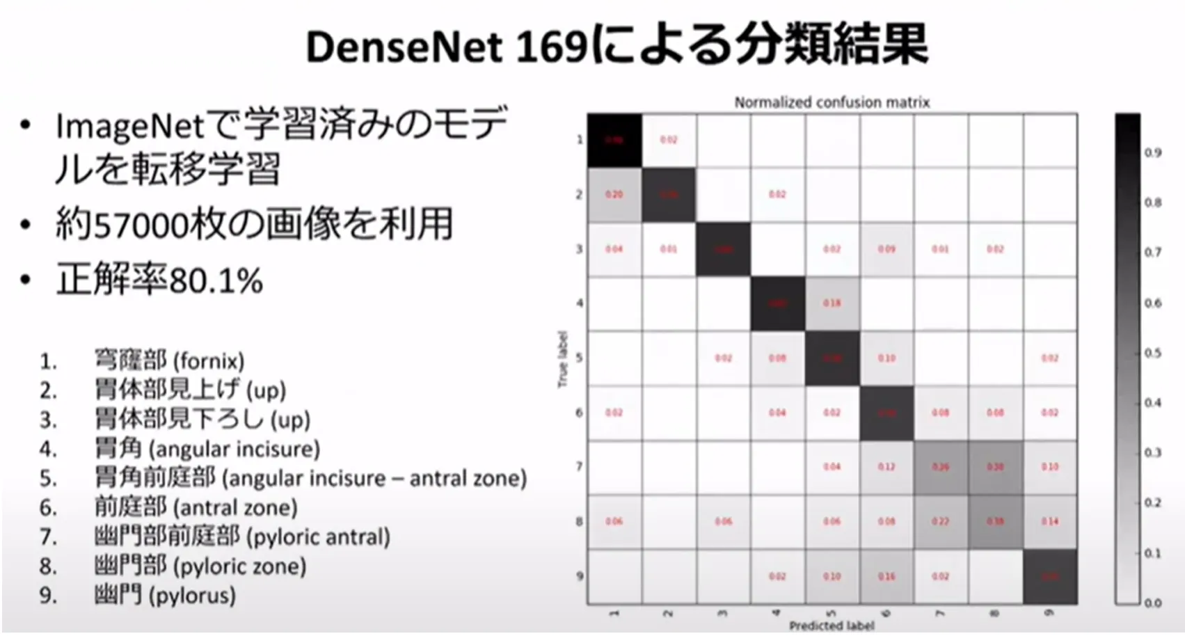 胃がん診断・治療のすべての段階でAI利活用の可能性を探る！名古屋大学大学院・森健策教授による最新研究の紹介（第94回日本胃癌学会総会）