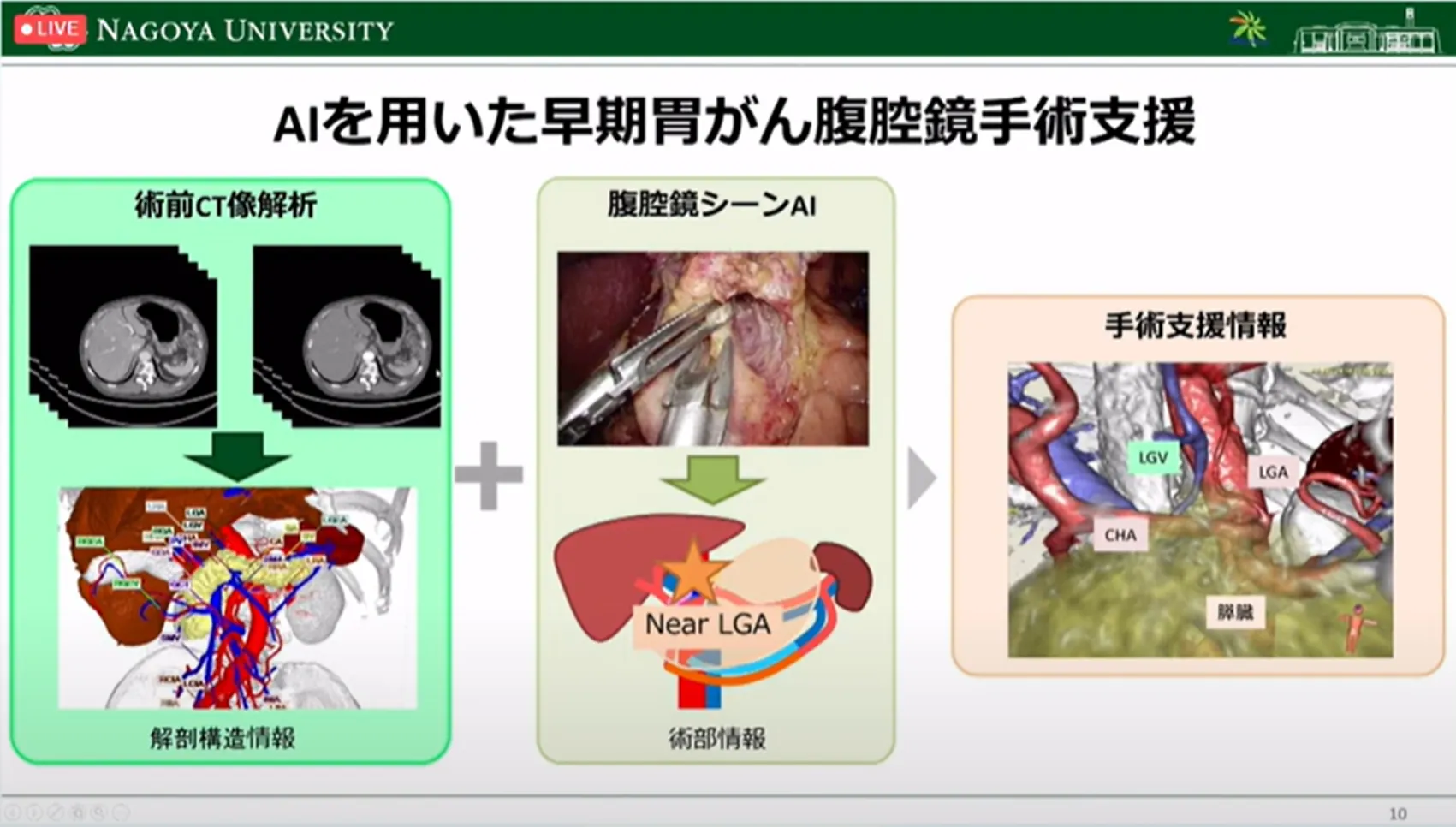 胃がん診断・治療のすべての段階でAI利活用の可能性を探る！名古屋大学大学院・森健策教授による最新研究の紹介（第94回日本胃癌学会総会）