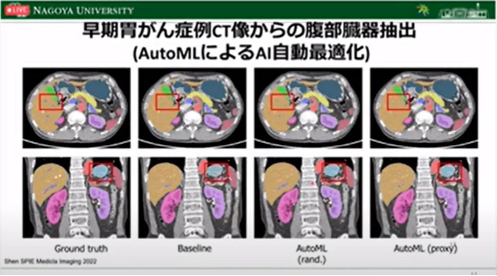 胃がん診断・治療のすべての段階でAI利活用の可能性を探る！名古屋大学大学院・森健策教授による最新研究の紹介（第94回日本胃癌学会総会）