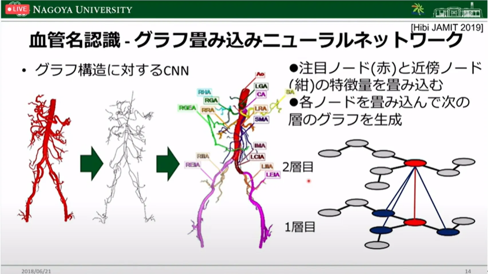 胃がん診断・治療のすべての段階でAI利活用の可能性を探る！名古屋大学大学院・森健策教授による最新研究の紹介（第94回日本胃癌学会総会）