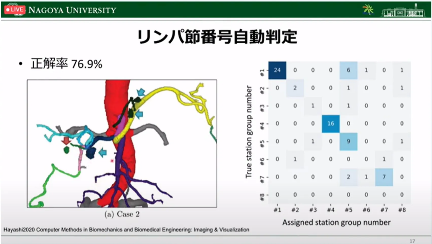 胃がん診断・治療のすべての段階でAI利活用の可能性を探る！名古屋大学大学院・森健策教授による最新研究の紹介（第94回日本胃癌学会総会）