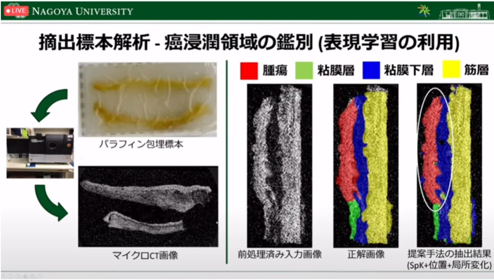 胃がん診断・治療のすべての段階でAI利活用の可能性を探る！名古屋大学大学院・森健策教授による最新研究の紹介（第94回日本胃癌学会総会）