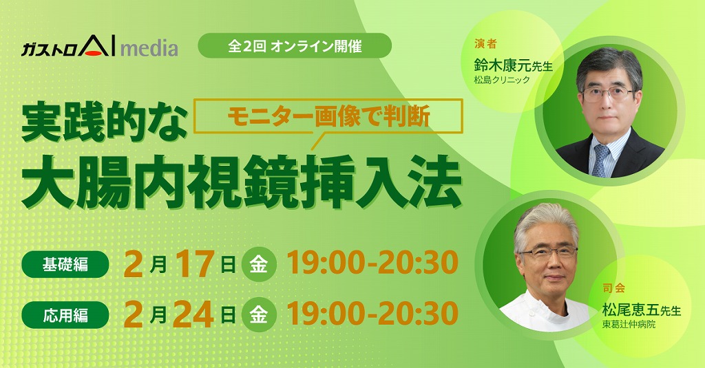 モニター画像で判断、実践的な大腸内視鏡挿入法（全2回）