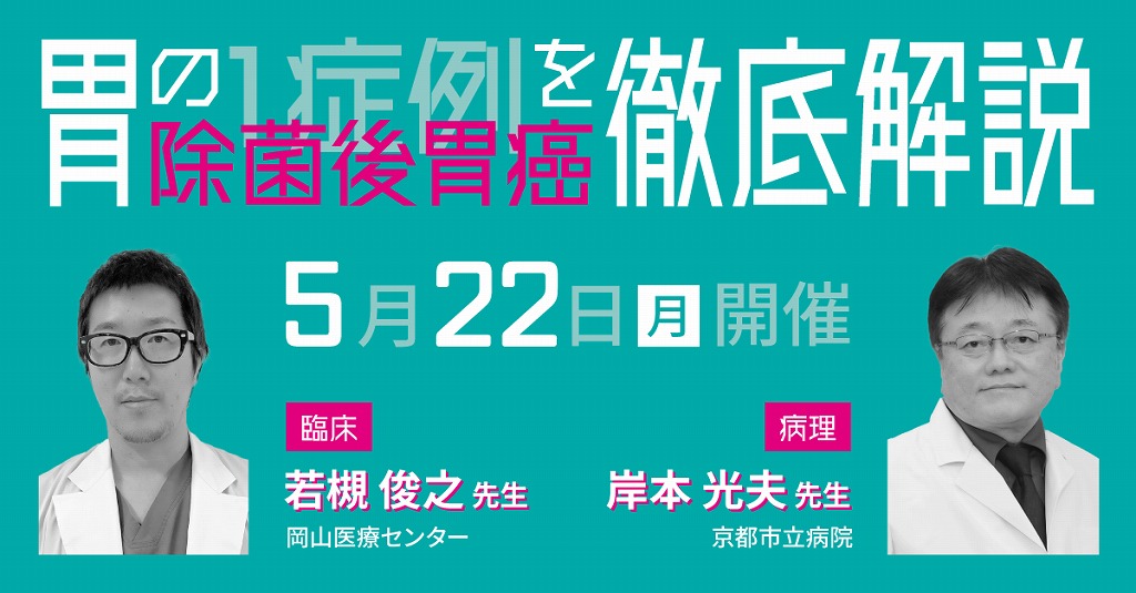 胃の「1症例」を徹底解説、今回のテーマは除菌後胃癌